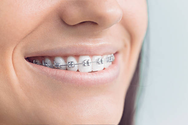 Best Traditional Braces  in Buffalo, OK